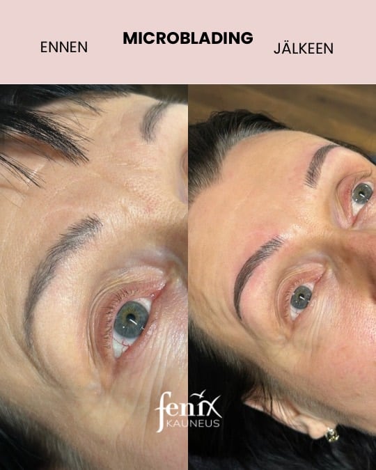 Microblading ennen ja jalkeen hoidon aikuiselle naiselle