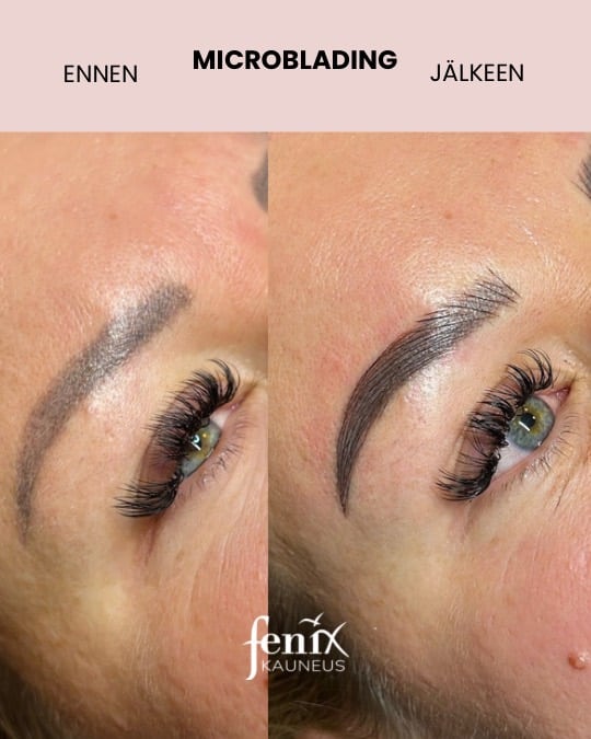 Microblading ennen ja jalkeen. Upea lopputulos.