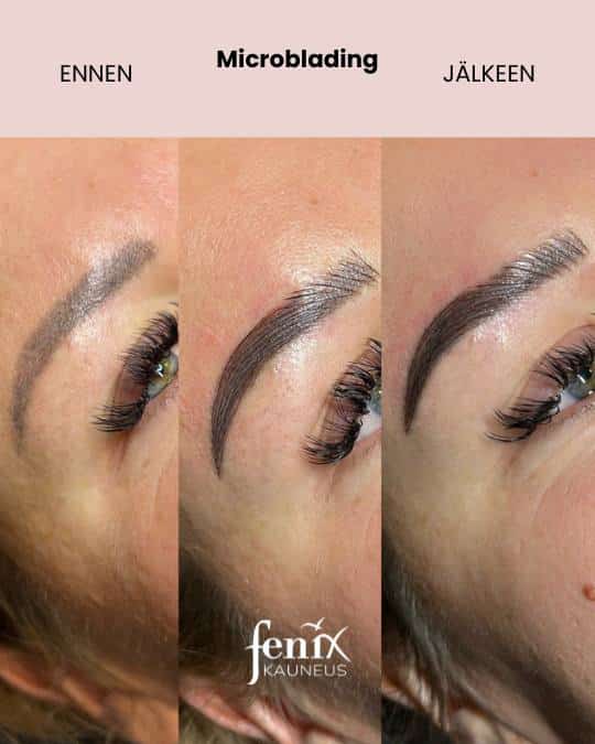 Microblading ensimaisen ja vahvistuskerran jalkeen.